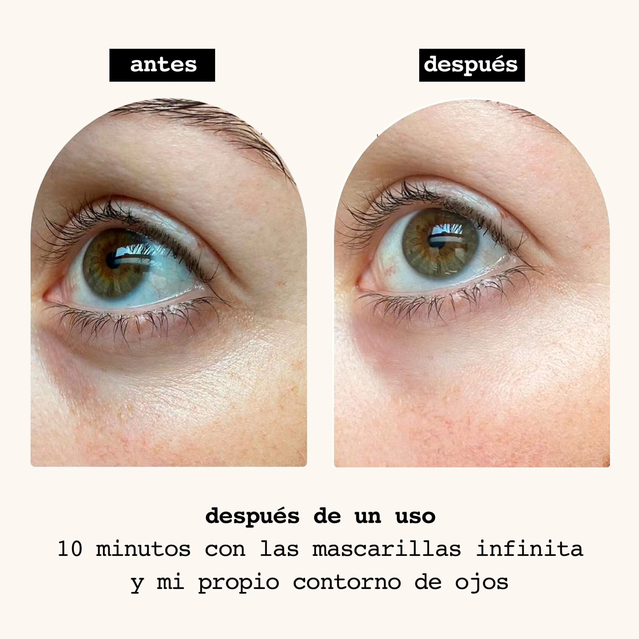 afrodite: mascarillas infinita